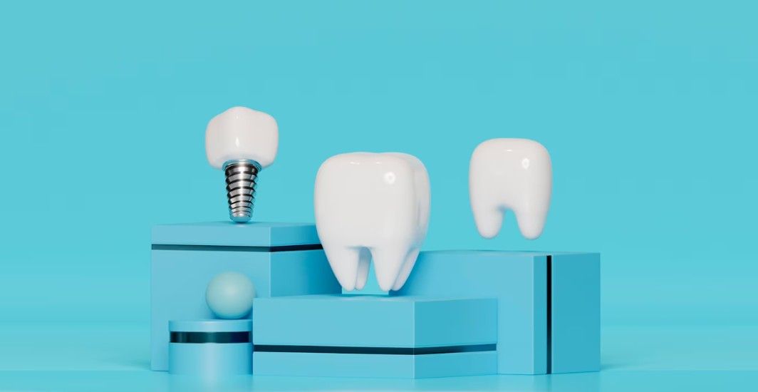 Managing Diabetes for Successful Dental Implants